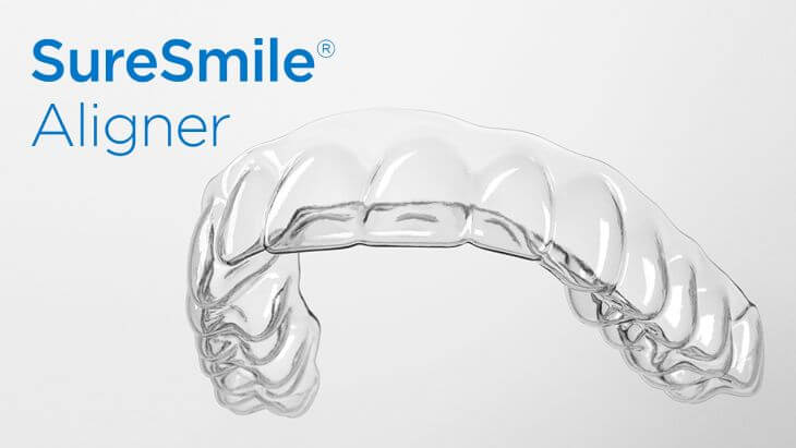 SureSmile Aligner